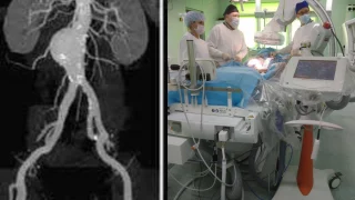 Омские хирурги за час избавили от боли пациента, которая мучила его более полугода