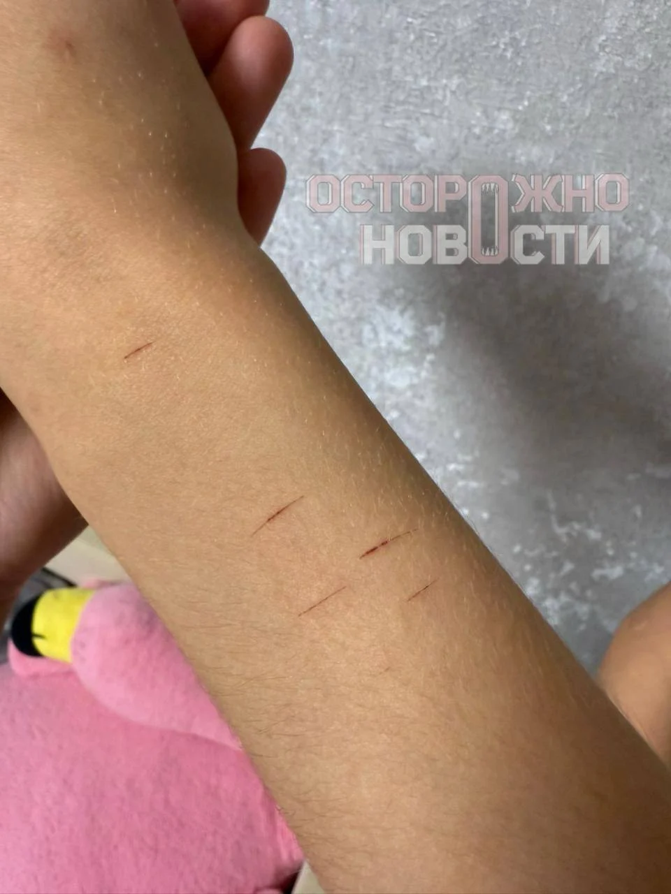 Прокуратура Омской области взяла под контроль дело о нападении на 11-летнюю девочку