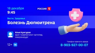 «Вести Здоровье. Болезнь Дюпюитрена»