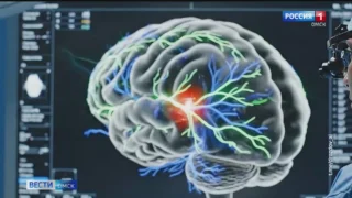 Омские нейрохирурги освоили новую технологию удаления опухолей в головном мозге