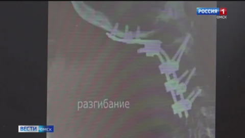 Врачи сразу двух лечебных учреждений Омска боролись за жизнь одной пациентки